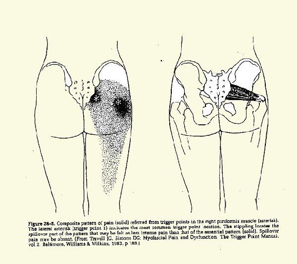 comment soigner vulvodynie