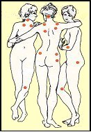 fibromyalgie